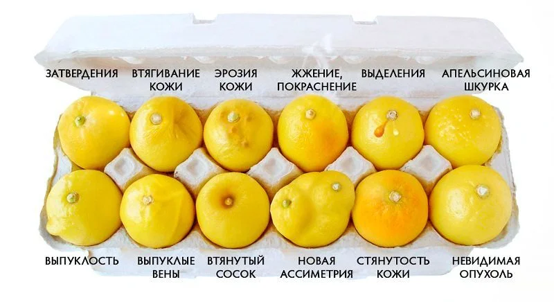 Расчёт риска развития рака груди