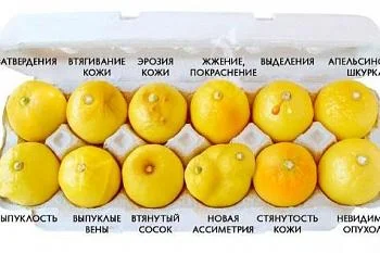 Расчёт риска развития рака груди